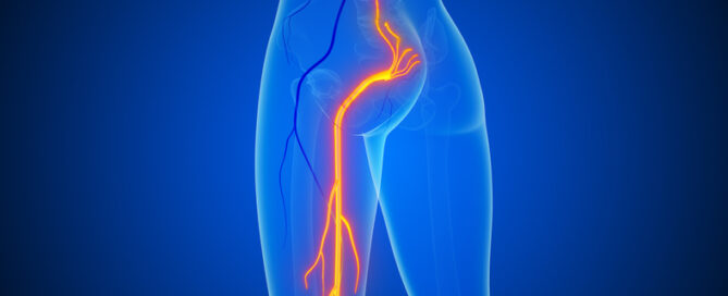 Illustration of the sciatic nerve highlighted along the back of the leg, representing Rolfing® for sciatica relief in Rockville, MD